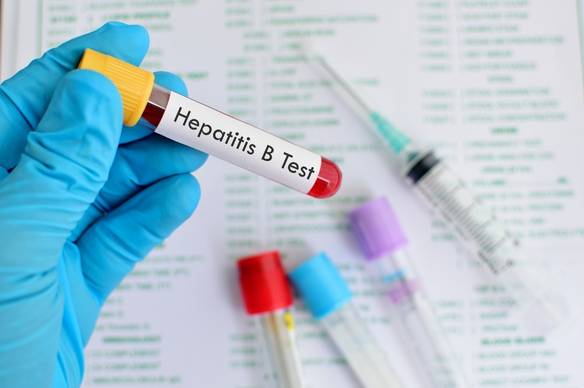Hepatitis B