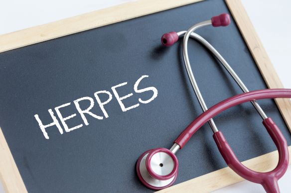 tipos de herpes